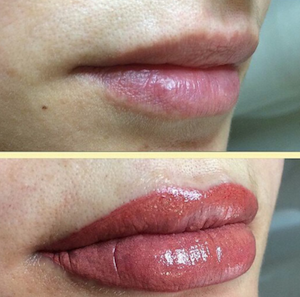 Vorher/Nachher, Permanent Makeup Lippen, 2