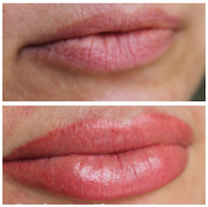 Vorher/Nachher, Permanent Makeup Lippen, 1